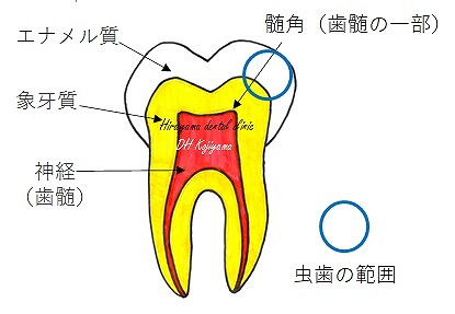 乳歯（特に奥歯）の特徴をご存知ですか？