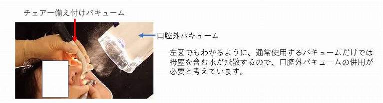 口腔外バキューム 各治療用チェアーに設置