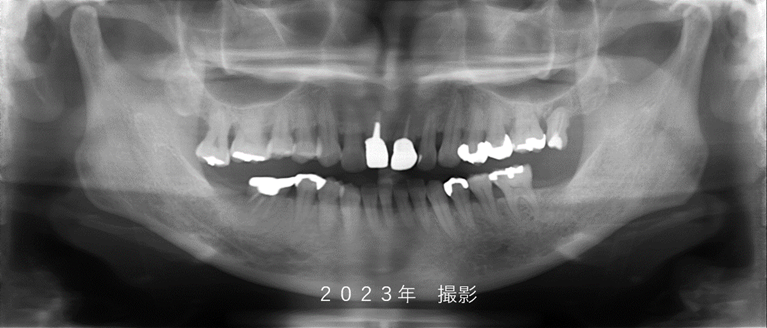 症例②